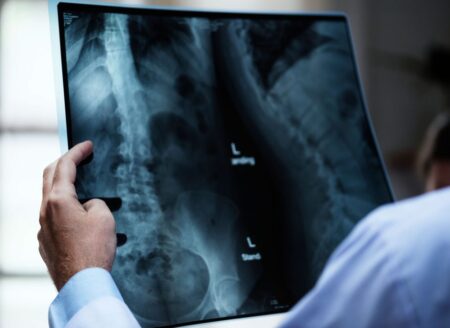 X-Ray