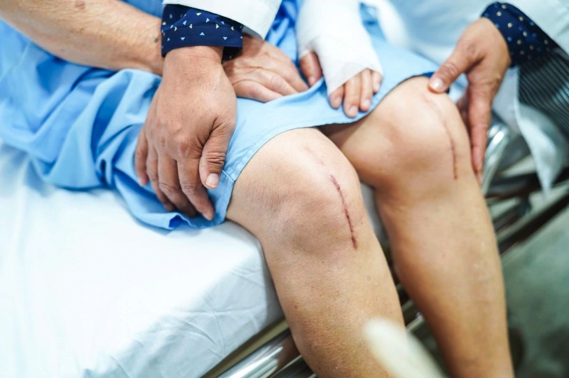 joint replacement